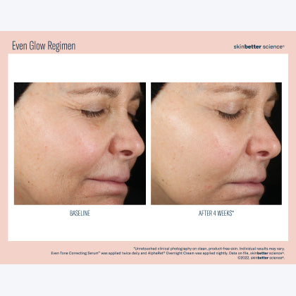 Skinbetter Science Even Glow Regimen