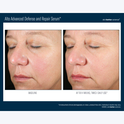 Skinbetter Science Alto Advanced Defense and Repair Serum