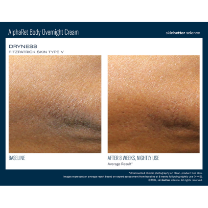 Skinbetter Science AlphaRet Body Overnight Cream