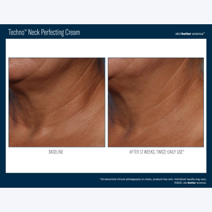 Skinbetter Science Techno Neck Perfecting Cream