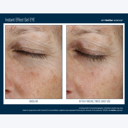 Skinbetter Science Instant Effect Gel EYE
