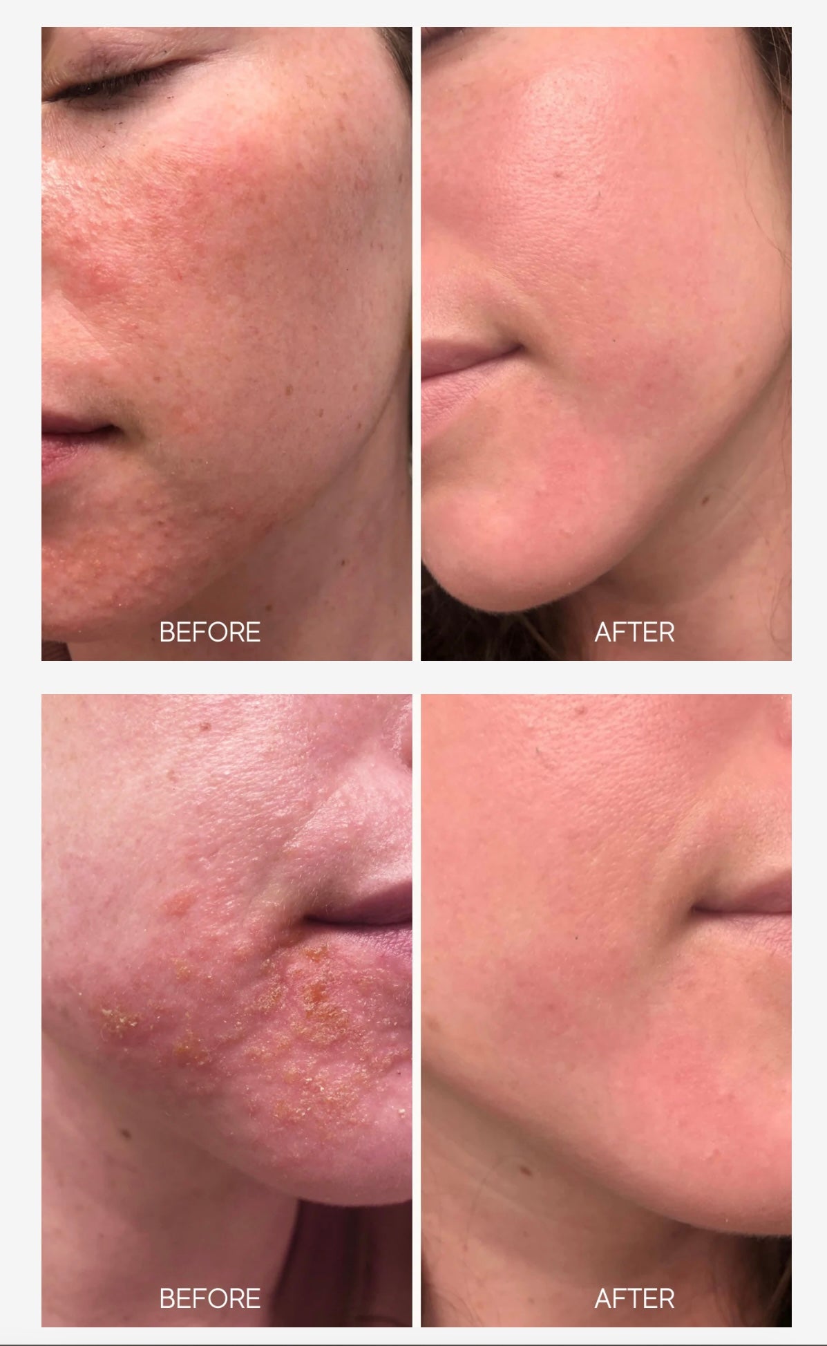 Glass Skin Liquid Exfoliant