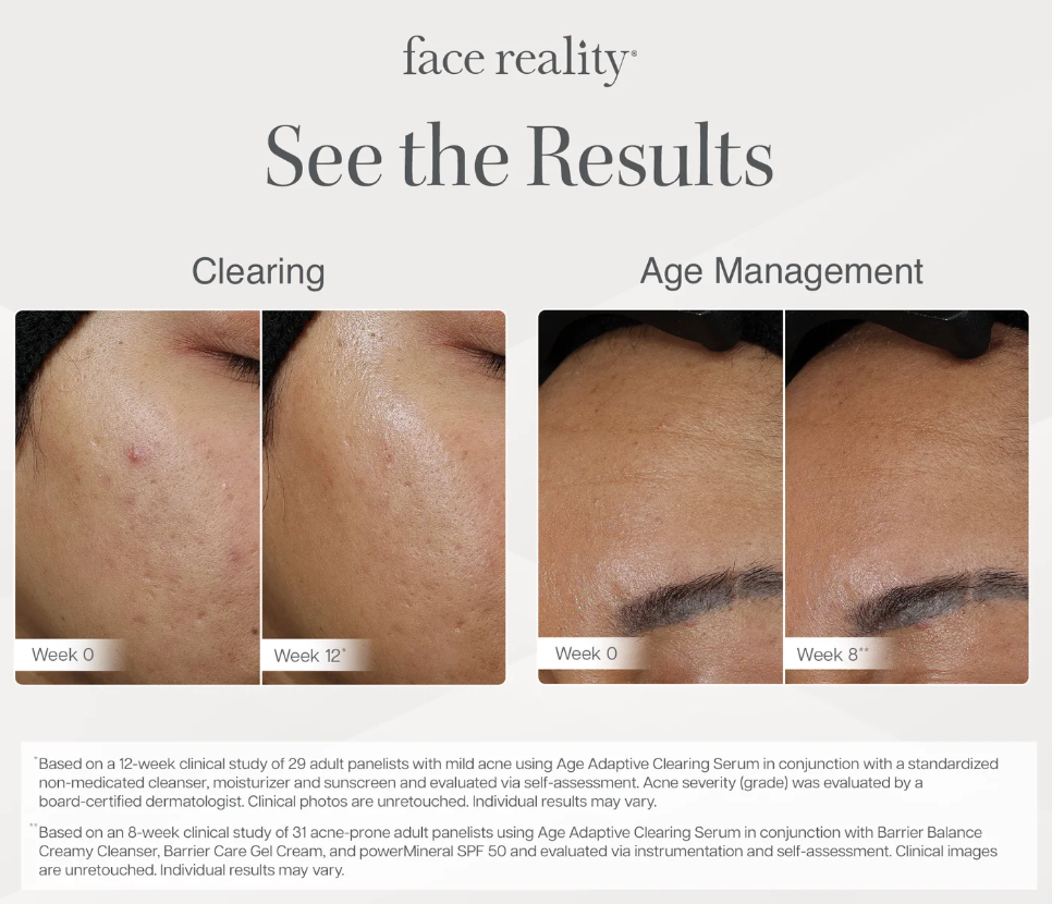 Age Adaptive Clearing Serum
