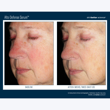 Skinbetter Science Alto Defense Serum