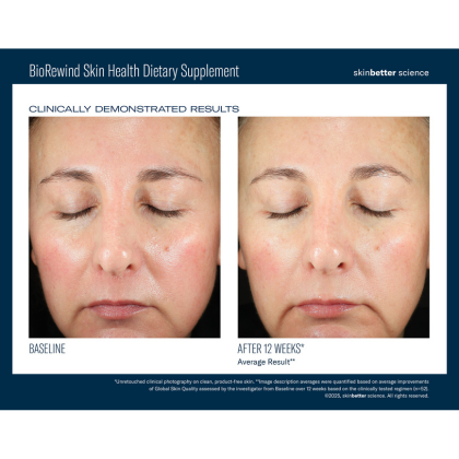 Skinbetter Science BioRewind Skin Health Dietary Supplement