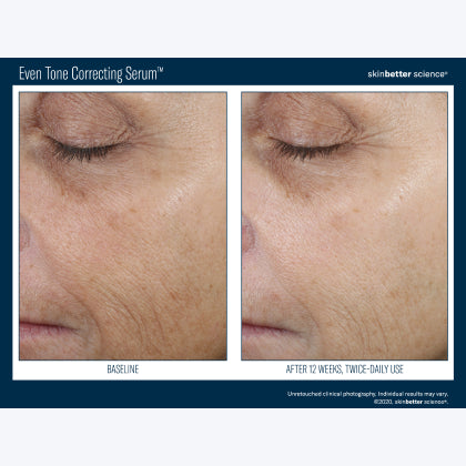 Skinbetter Science Even Tone Correcting Serum
