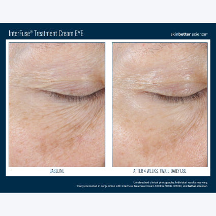 Skinbetter Science InterFuse Treatment Cream EYE