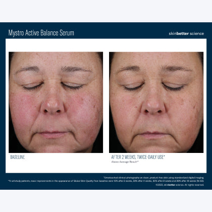 Skinbetter Science Mystro Active Balance Serum