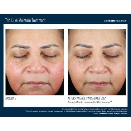 Skinbetter Science Trio Luxe Moisture Treatment