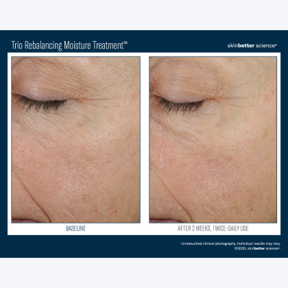 Skinbetter Science Trio Rebalancing Moisture Treatment