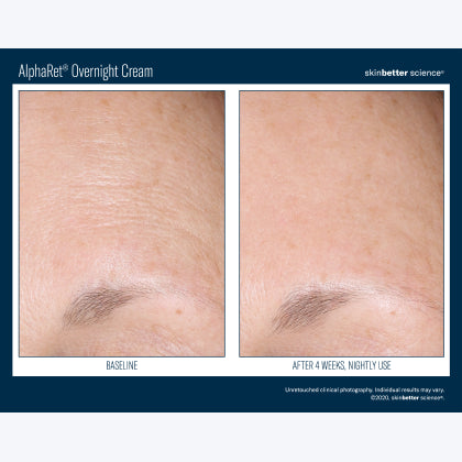 Skinbetter Science AlphaRet Overnight Cream