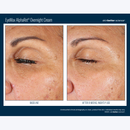 Skinbetter Science EyeMax AlphaRet Overnight Cream