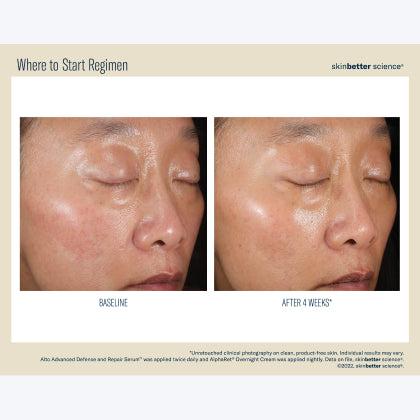 Skinbetter Science Where to Start Regimen