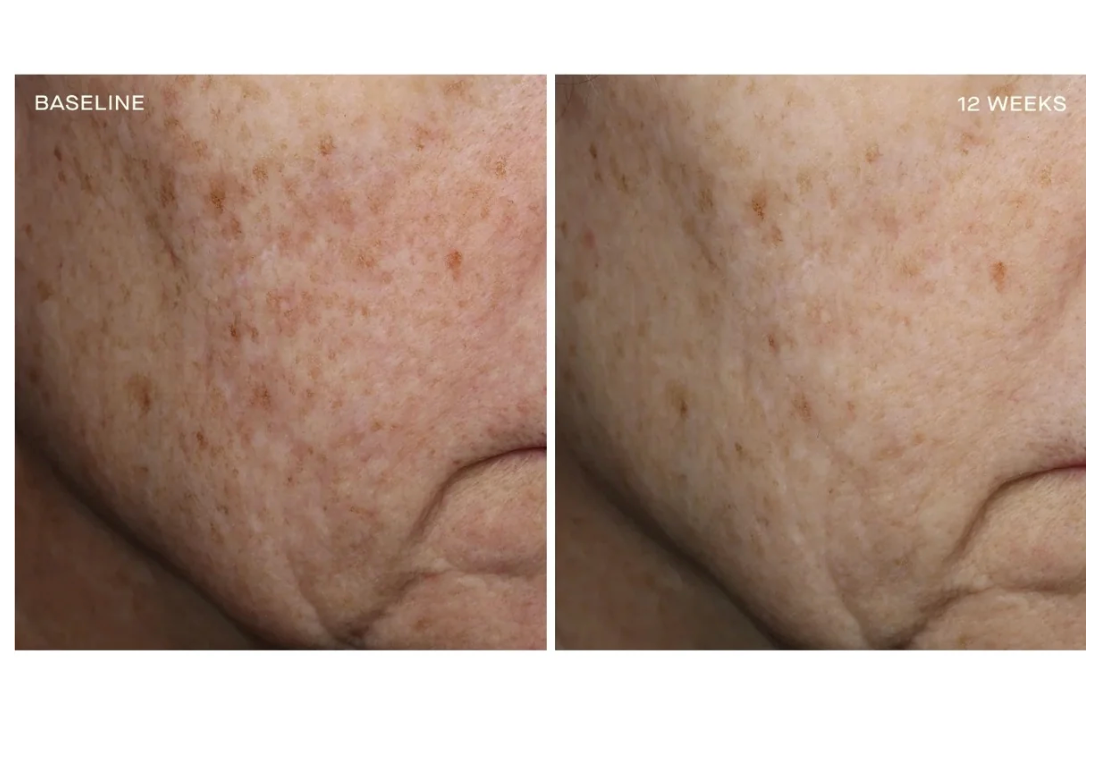 Complexion Brightening Serum