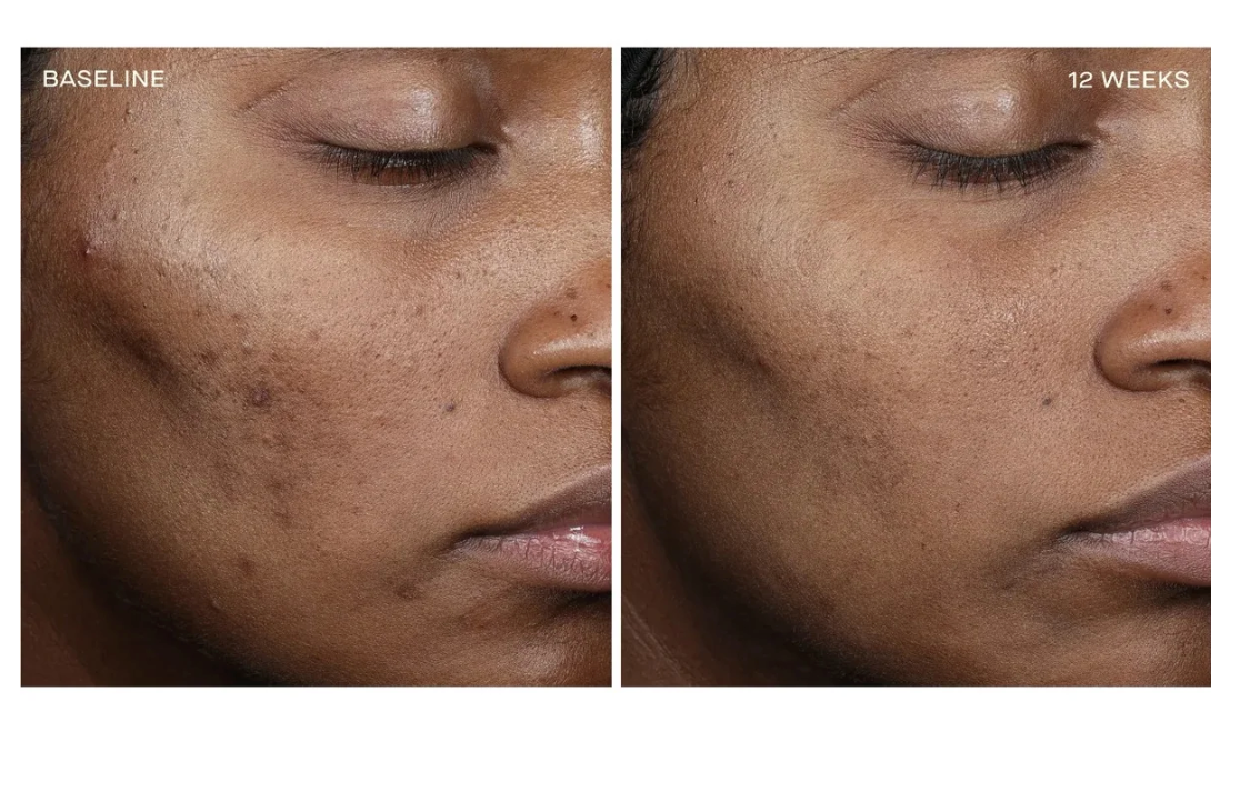 Complexion Brightening Serum
