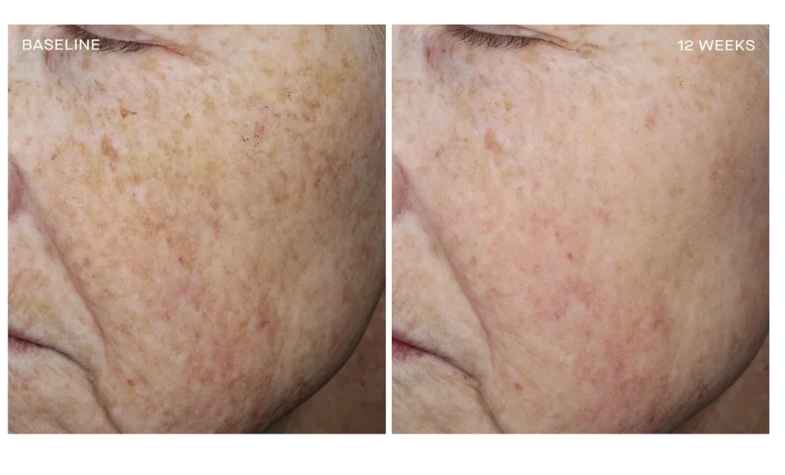 Complexion Brightening Serum