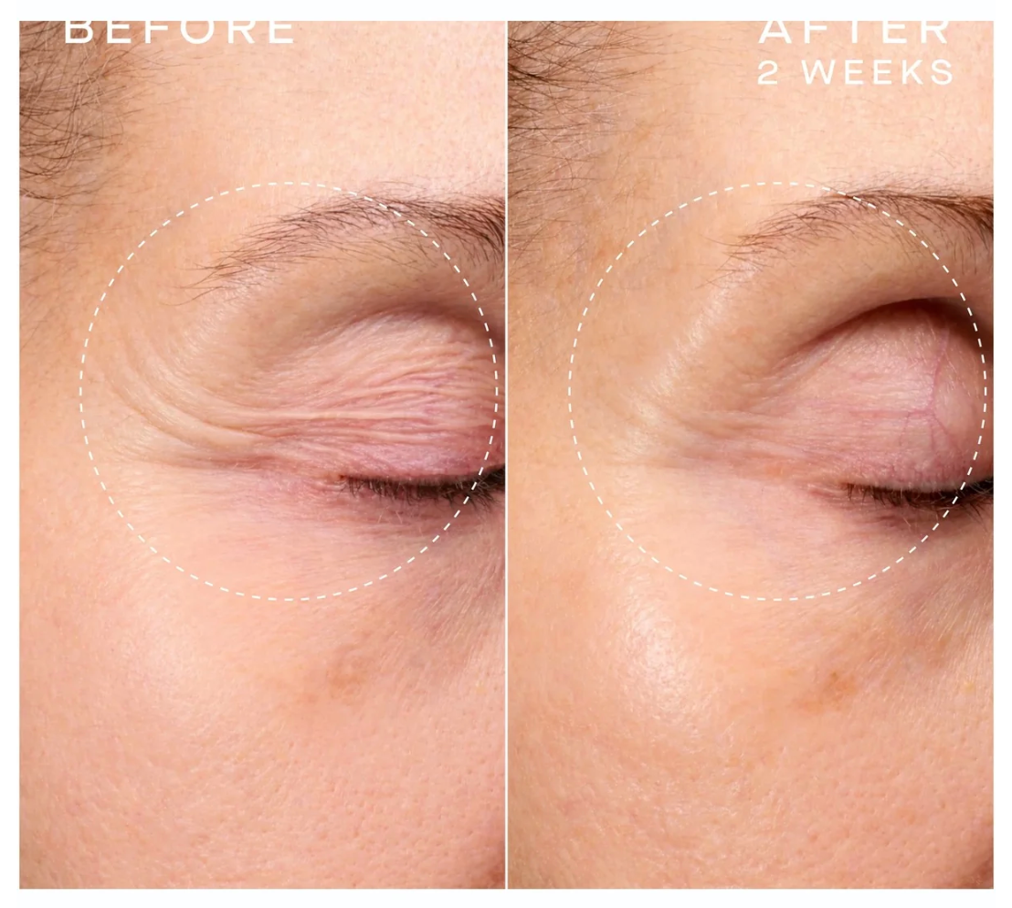 Advanced Regenerative Serum