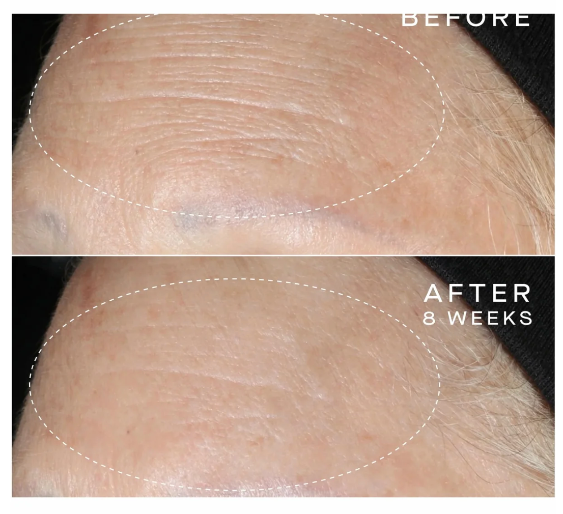 Advanced Regenerative Serum