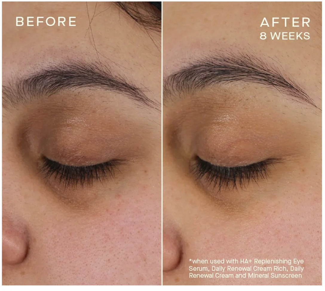 Advanced Regenerative Eye Serum