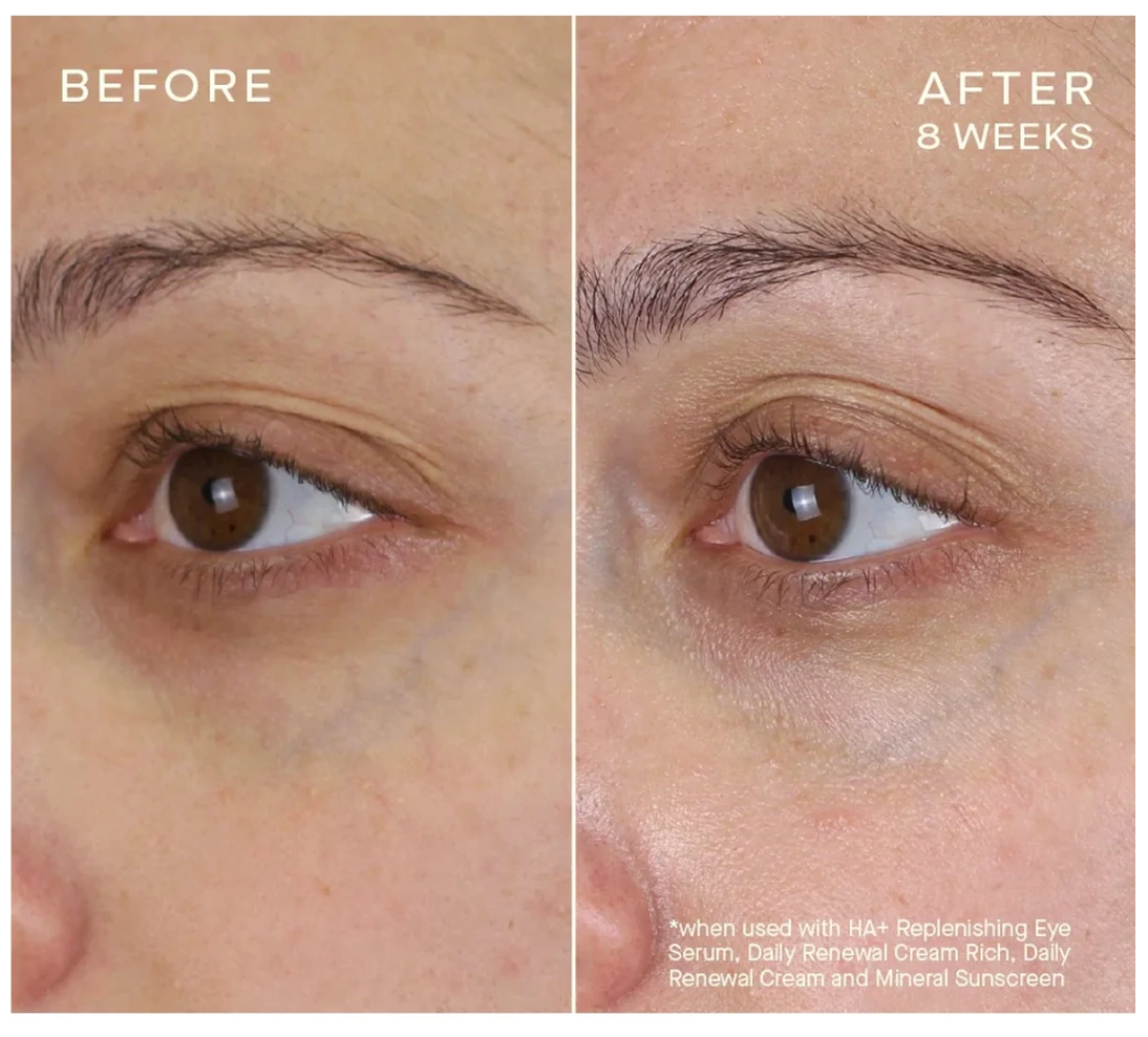 Advanced Regenerative Eye Serum