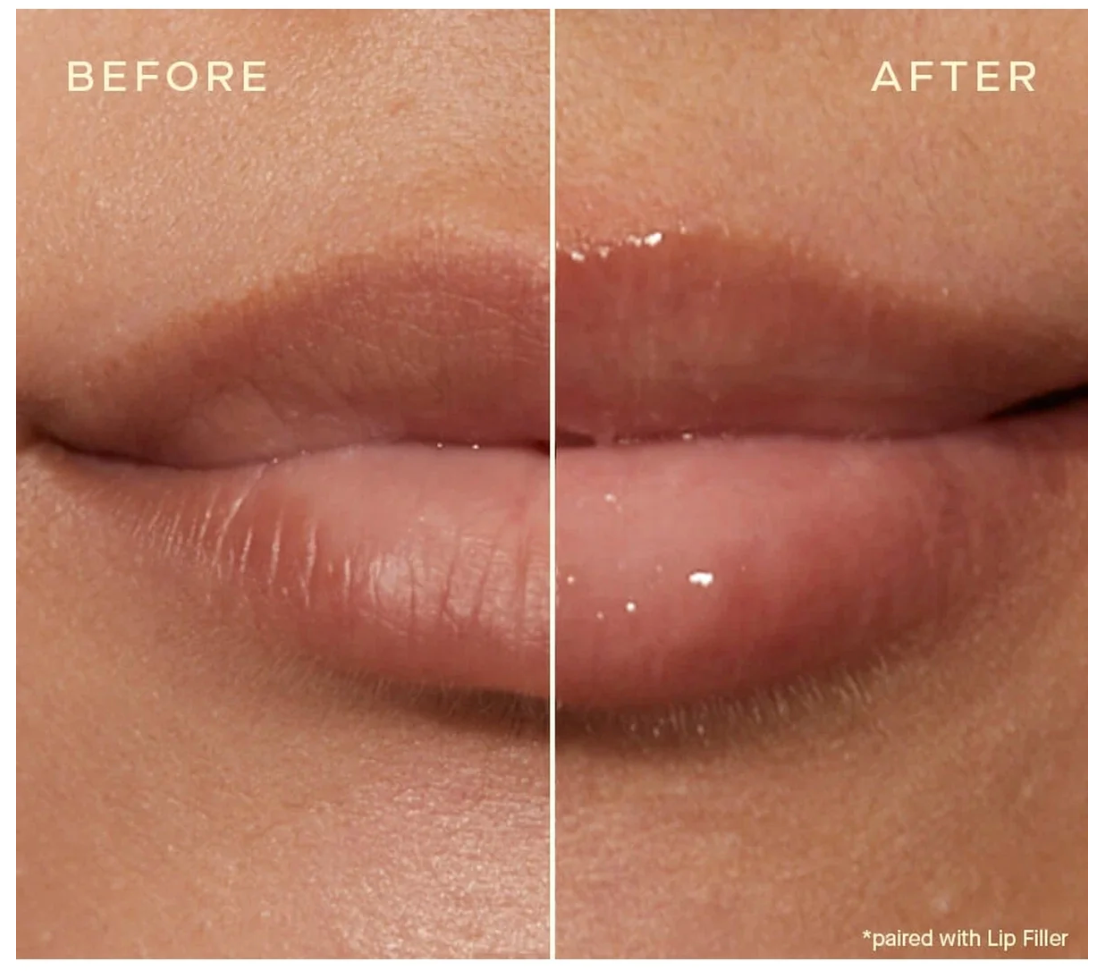 Lip Conditioner
