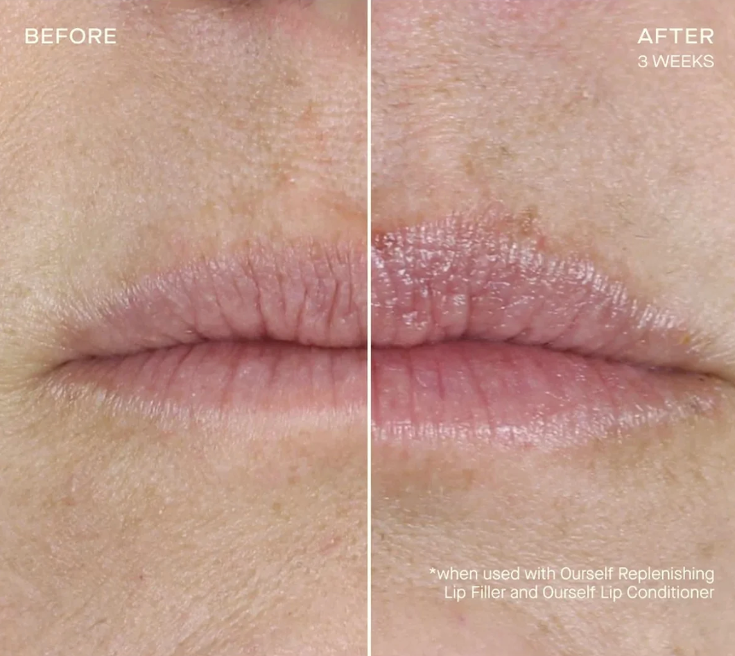 Replenishing Lip Filler