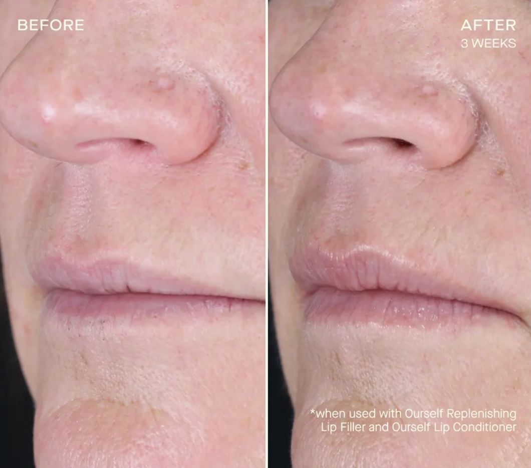 Replenishing Lip Filler